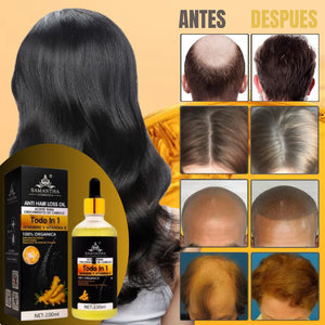 ACEITE TODO EN UNO ANTICAIDA Y CRECIMIENTO DE CABELLO SAMANTHA®